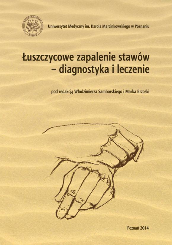 Łuszczycowe Zapalenie Stawów Diagnostyka I Leczenie Wydawnictwo Naukowe 4397