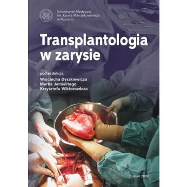 Transplantologia w zarysie