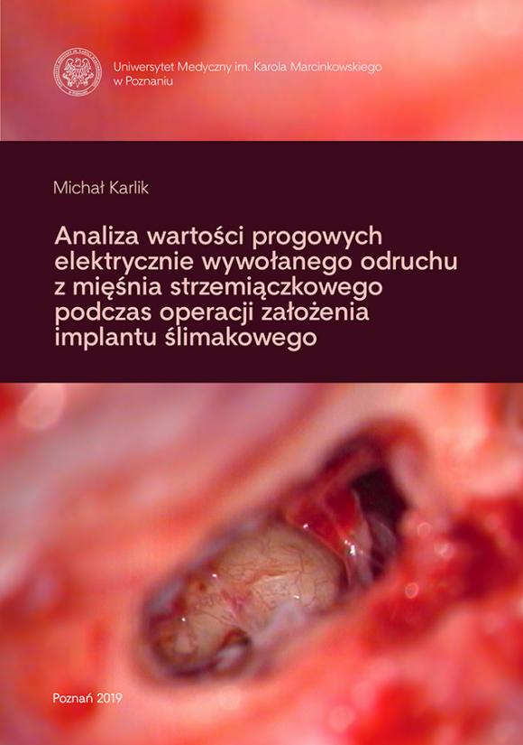 Analiza wartości progowych elektrycznie wywołanego odruchu z mięśnia strzemiączkowego podczas operacji założenia implantu ślimakowego